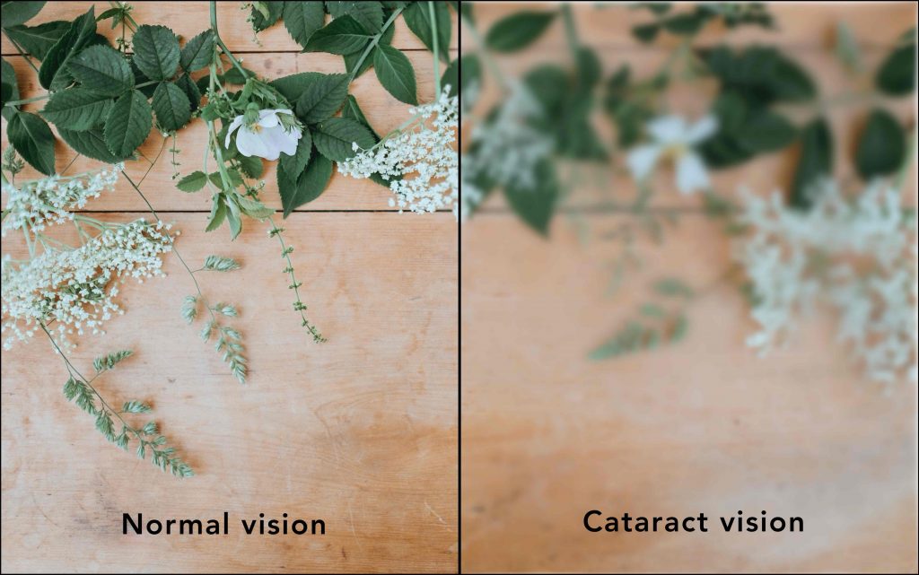 cataract vision difference